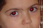 correzione occhi rossi